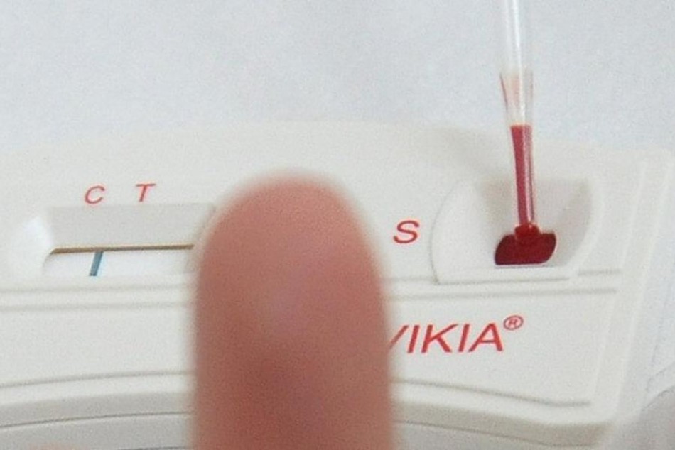 130701 | Convocan a ONGs para co-financiar proyectos sobre VIH/Sida -